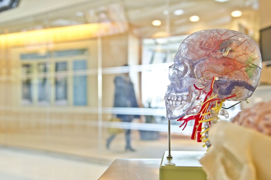 A Alzheimer acontece quando placas da proteína amilóide se depositam no cérebro do indivíduo