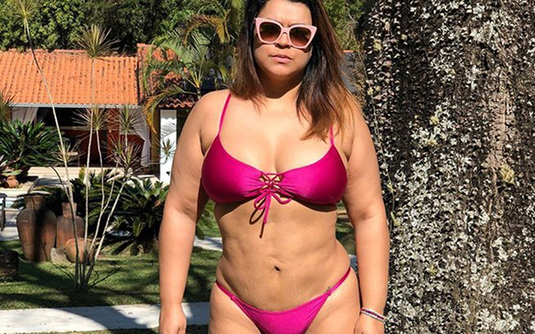 A cantora defende que é preciso rever os padrões de beleza que estão enraizados na sociedade