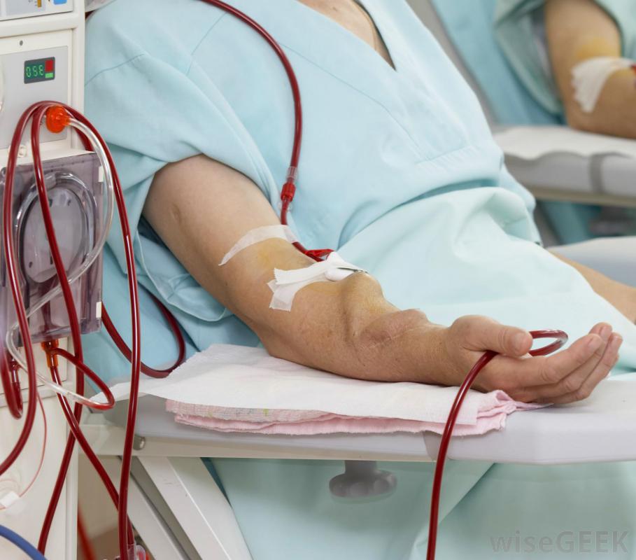 Apesar dos custos elevados, a hemodiálise sozinha não é suficiente e necessita de terapia medicamentosa de apoio, o que pode aumentar em até 50% esse custo