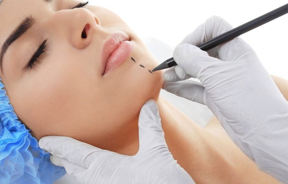 O cirurgião plástico Dr. Marco Cassol, destaca que toda cirurgia apresenta riscos e é preciso compreender os motivos que levam a paciente a querer a modificação corporal ou facial
