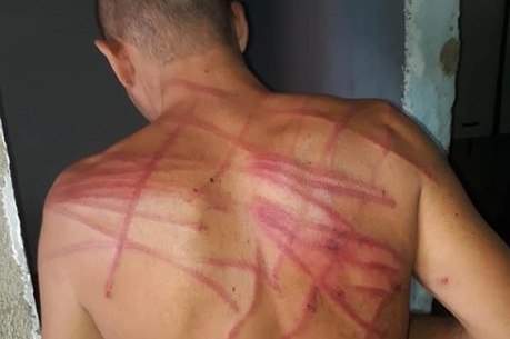 Enquanto voltava do futebol, três homens o cercaram e começaram a batê-lo com um chicote de rabo de tatu