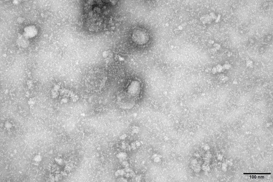 Dos nove casos em investigação, quatro estão no Lacen para a realização de exames preliminares para Influenza e mais oito tipos de vírus respiratórios