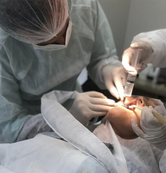 A cirurgia guiada” é, na verdade, uma cirurgia sem cortes na gengiva para instalação dos implantes