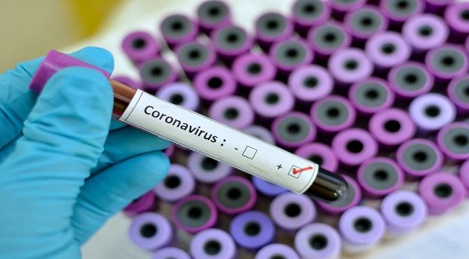 Em Mato Grosso do Sul, foram registrados 14 óbitos por coronavírus no Estado e são 479 casos confirmados da doença.