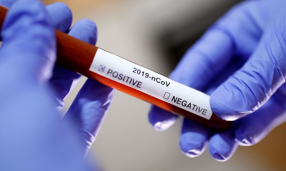 O Ministério da Saúde incluiu hoje (20) a cloroquina, e seu derivado hidroxicloroquina, no protocolo de tratamento para pacientes com sintomas leves de covid-19