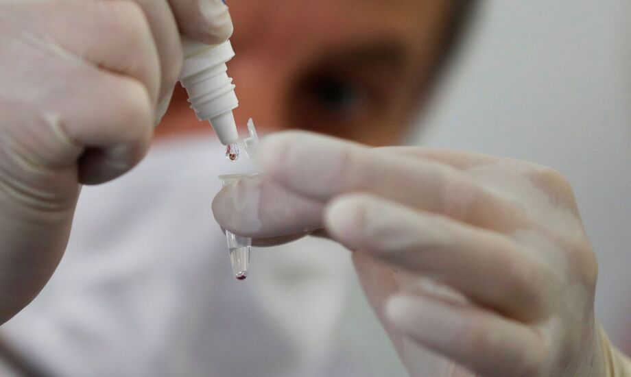 A letalidade (número de mortes pela quantidade de casos confirmados) da doença no país está em 6,3%.
