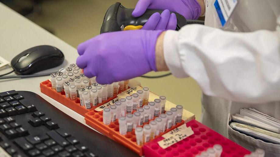 Os casos de infecção pelo o novo coronavírus se aproximam de seis milhões no mundo inteiro, de acordo com a última atualização do painel com curadoria da Universidade Johns Hopkins, nos Estados Unidos
