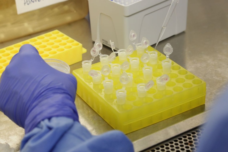 A Hapvida anunciou a aquisição de 19 mil testes para detecção de infectados pelo novo coronavírus