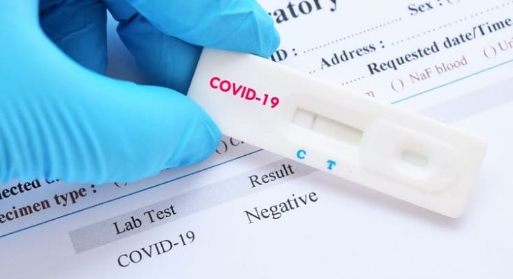 Os testes para a detecção do vírus da Covid-19 ainda geram dúvidas entre a população