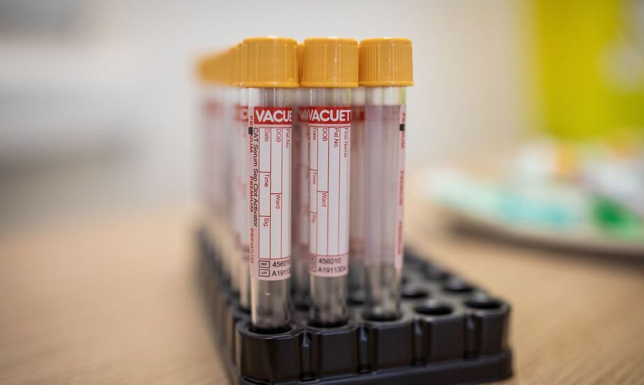 Do total de infectados, 927.292 já se recuperaram