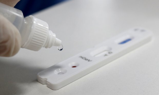 Serão realizados 400 testes por dia