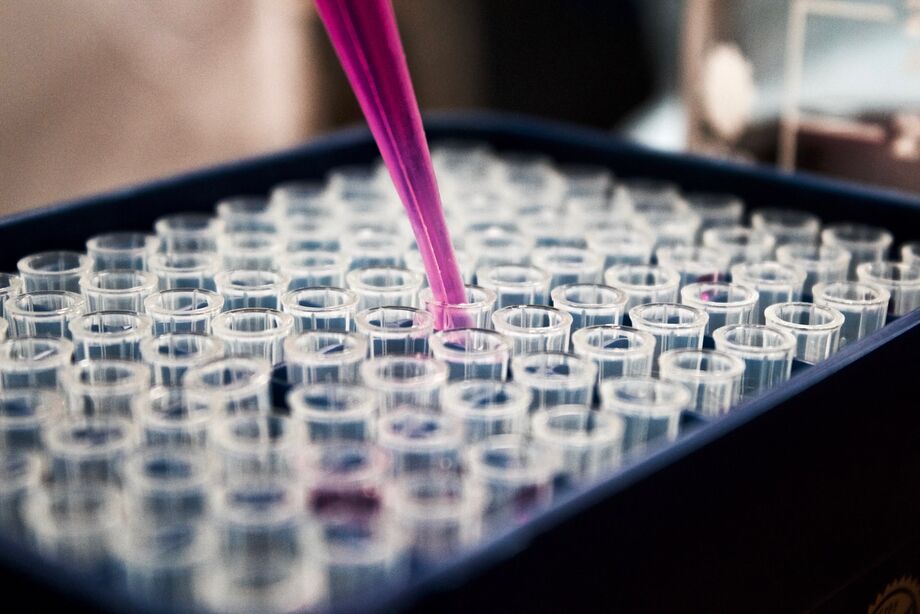 Os laboratórios pesquisados foram Célula, Multilab, Biodiagnostic, Labclin, Novalab , Oswaldo Cruz, Sabin e Ultralab.