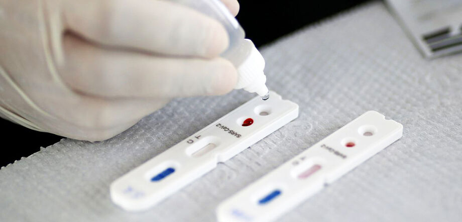 Existe diferenças entre os testes