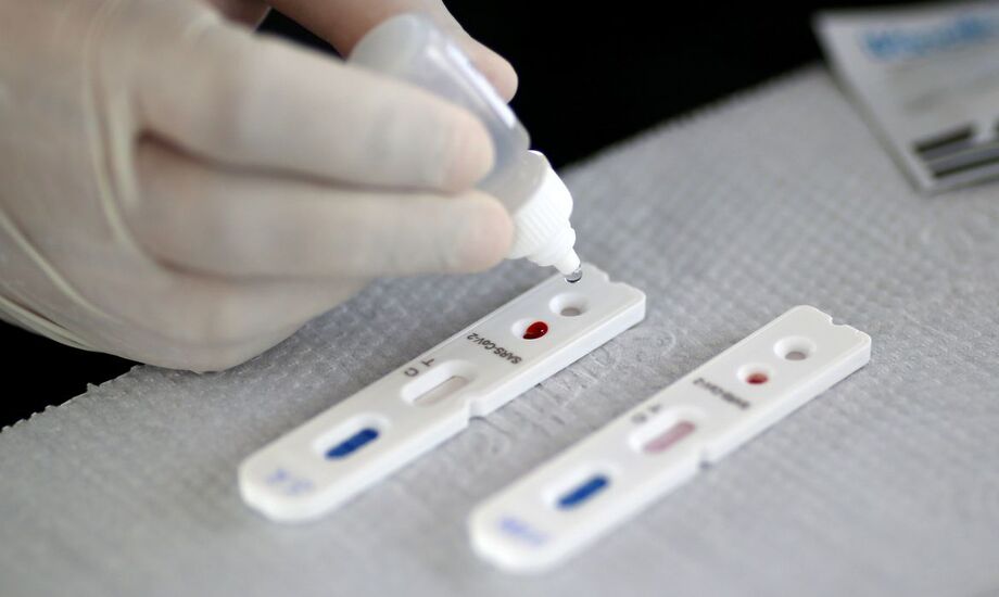 Estado registrou 11.757 mortes e 114 mil pessoas de recuperaram