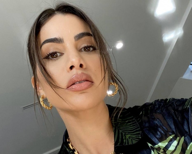 A influenciadora digital Camila Coelho revela que tem epilepsia