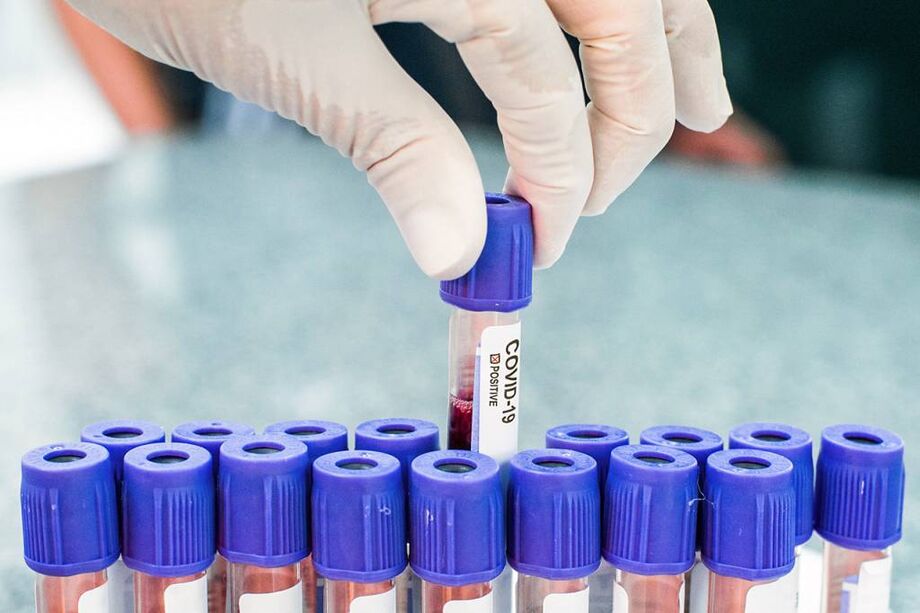 Os casos suspeitos em investigação tiveram as amostras encaminhadas para laboratório
