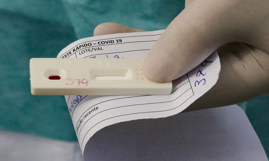 Até 200 pessoas por dia podem realizar o exame e o resultado sai após 72h.
