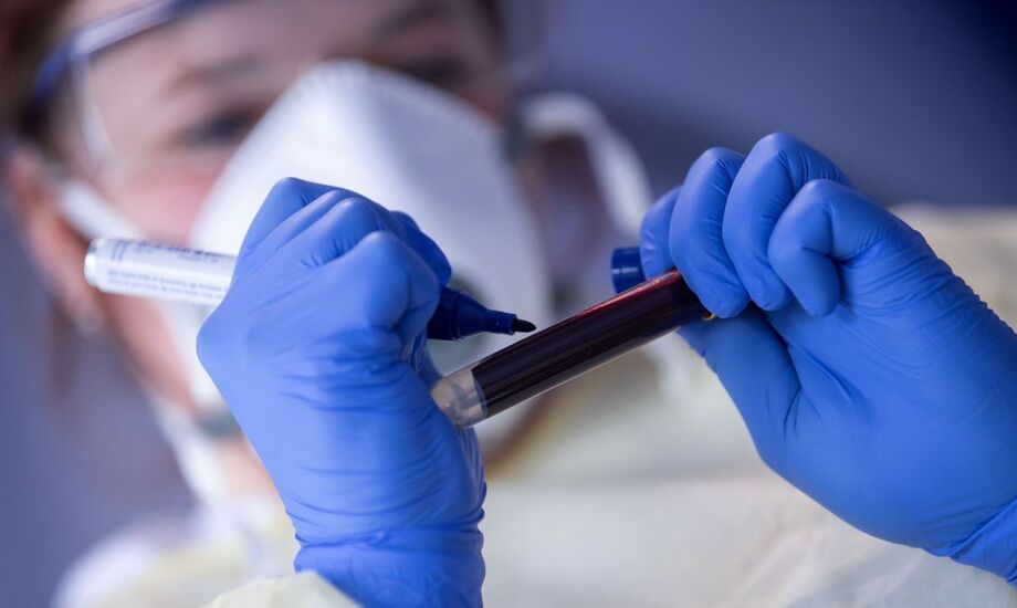 Casos confirmados passam de 175 mil desde o início da pandemia