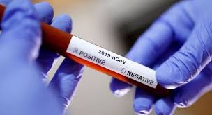 Neste sábado, quando o Brasil ultrapassou a marca de 100 mil mortos pela covid-19, também se alcançou o número de 3.013.369 casos confirmados