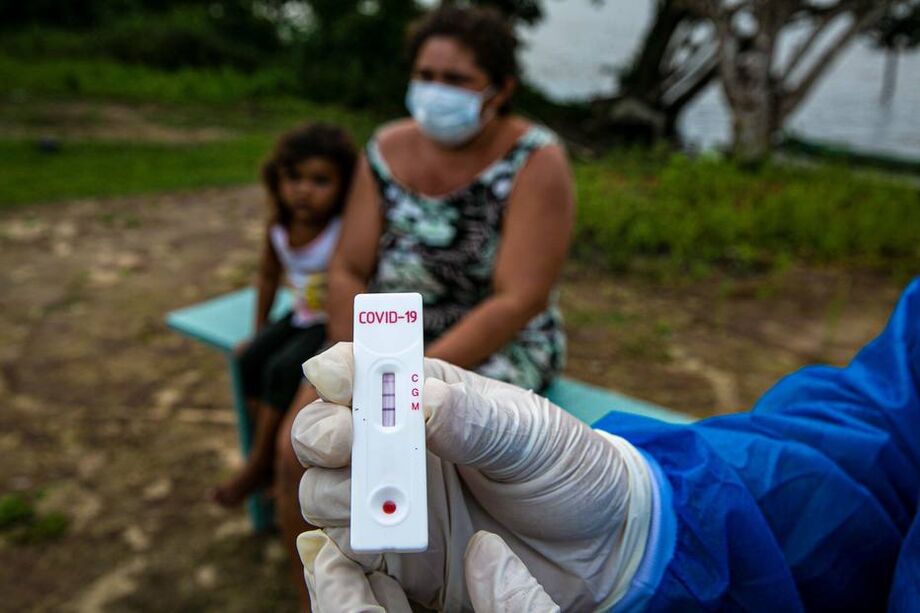 Testes sorológicos para detectar o novo coronavírus podem ser encontrados em diferentes laboratórios e até em farmácias