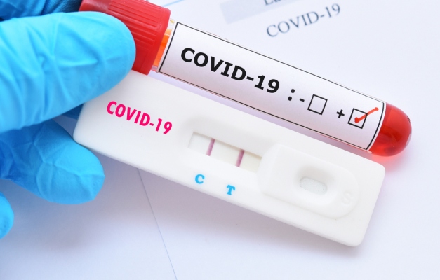 Brasil notifica 60.091 casos de covid-19 em 24h
