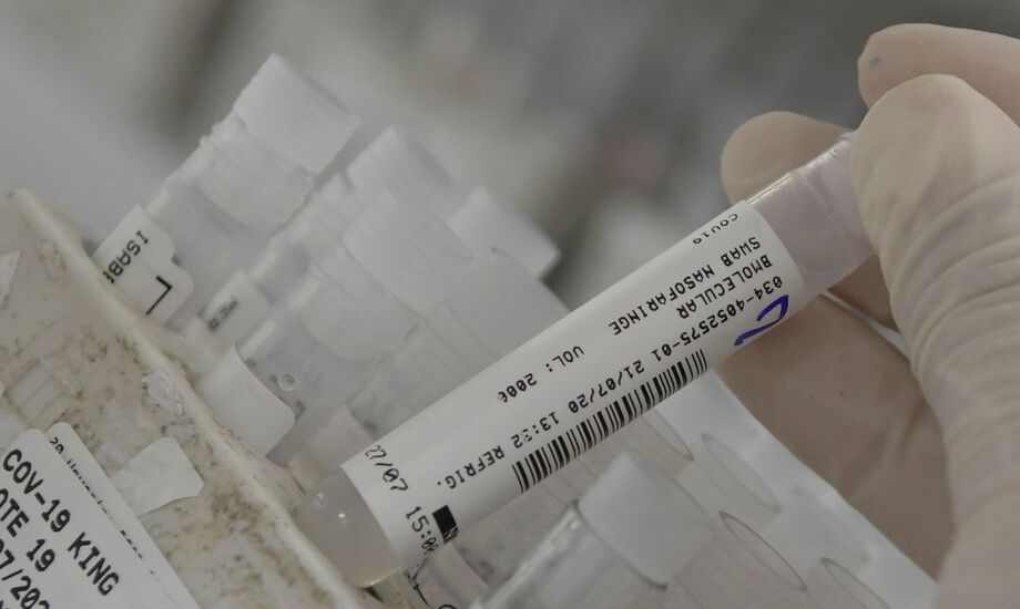 O preço dos medicamentos vendidos aos hospitais do país subiu 16,4% durante os cinco primeiros meses da pandemia da covid-19 no Brasil, de março e julho.