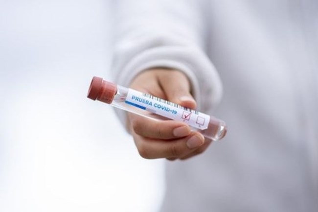 Ainda de acordo com a Johns Hopkins, países que registram maior número de infecções por covid-19 em números absolutos, após os Estados Unidos, são o Brasil (3.717.156), Índia (3.310.234), Rússia (972.972) e África do Sul (618.286).