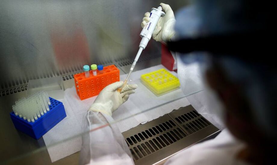 Estudo analisa processo de reinfecção do novo coronavírus
