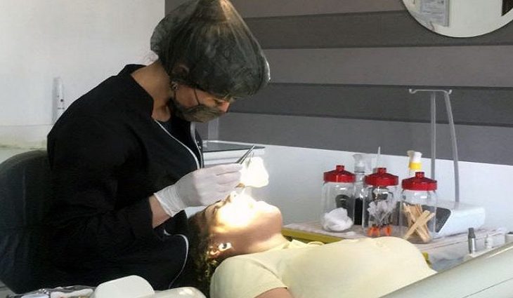 Com três meses de tratamento, foram realizadas restaurações, extração, limpeza e colocação de próteses superior e inferior.