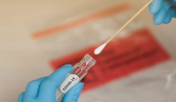 Com o adicional o número total de infectados desde o início da pandemia no Estado sobe para 59.408