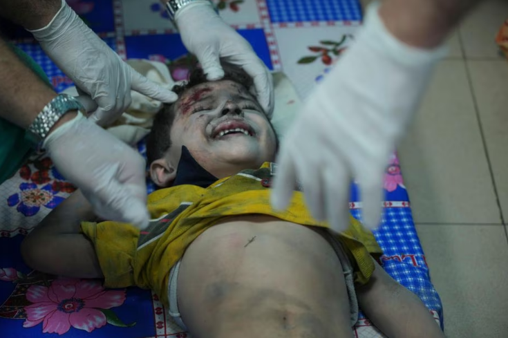 Criança palestina ferida em bombardeio israelense a hospital na Faixa de Gaza  