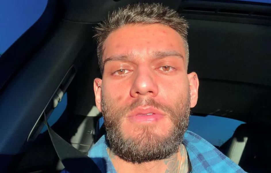 Lucas Lucco realizou harmonização facial em 2019