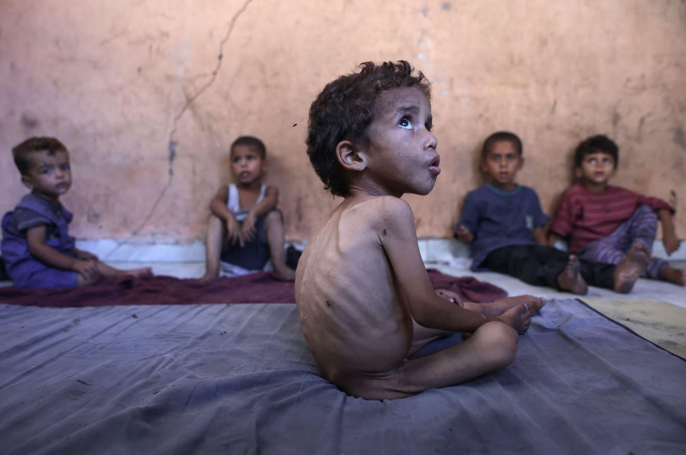 Imagem do dia 23 mostra Yazan, uma criança palestina de dois anos de cidade, ao lado dos irmãos em um campo de refugiados na Faixa de Gaza. Mais de 100 organizações internacionais denunciam má nutrição em Gaza