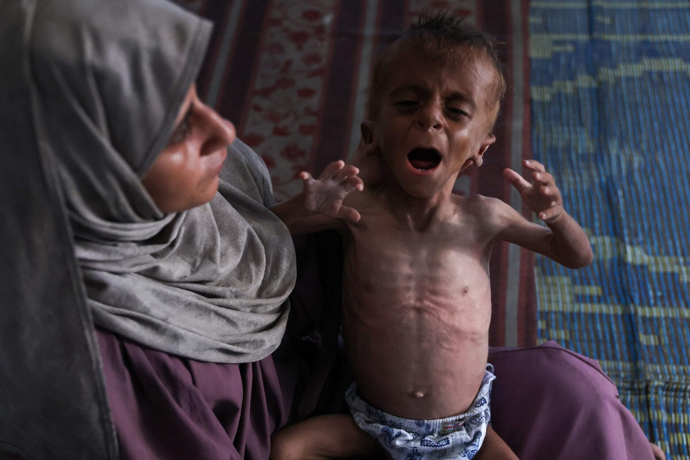 Hidaya, uma mãe palestina de 31 anos, embala seu filho doente de 18 meses, Mohammed al-Mutawaq, que também apresenta sinais de desnutrição, dentro de sua tenda no campo de refugiados de Al-Shati, a oeste da cidade de Gaza, em 24 de julho de 2025