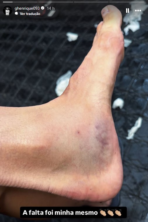 Gustavo Henrique ironiza árbitro e mostra tornozelo inchado após clássico 